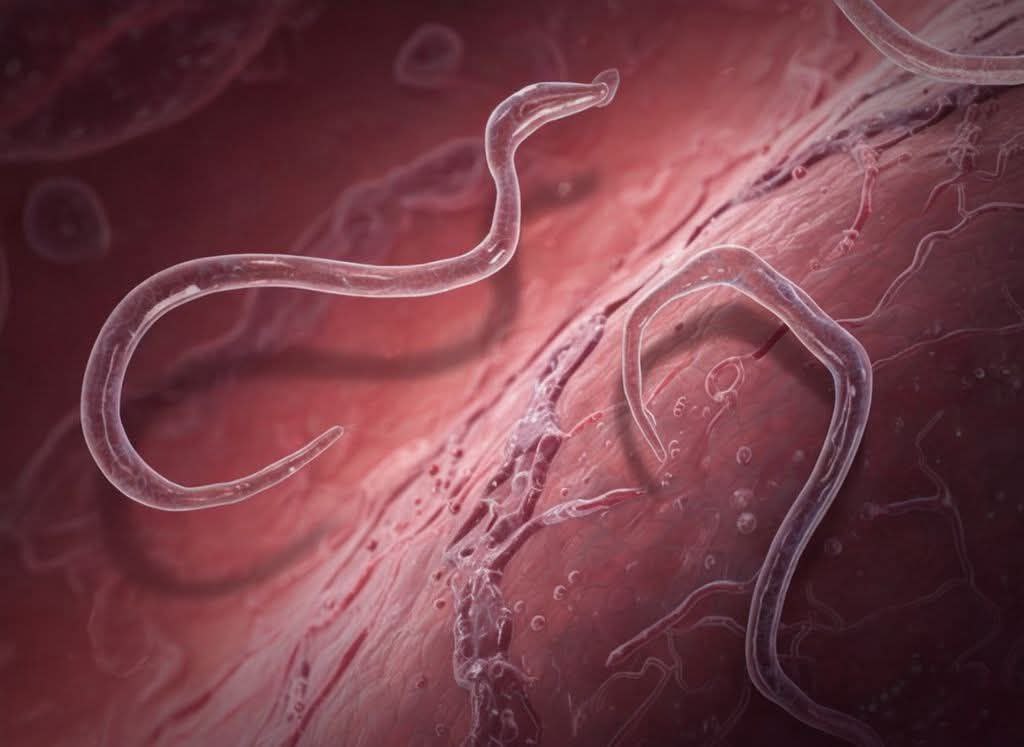 How to Treat Worms in Humans Naturally